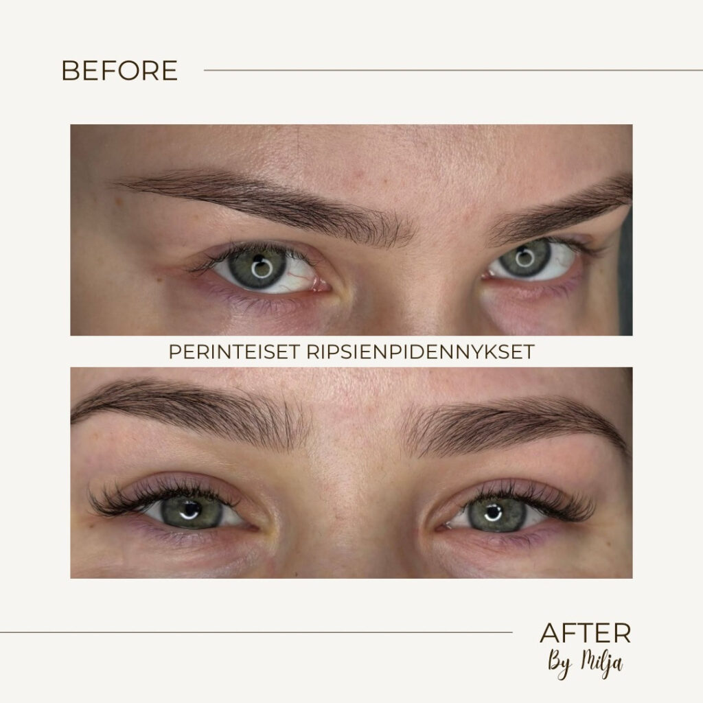 Klassiset ripset ennen ja jalkeen